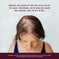 Women's Hair Regrowth