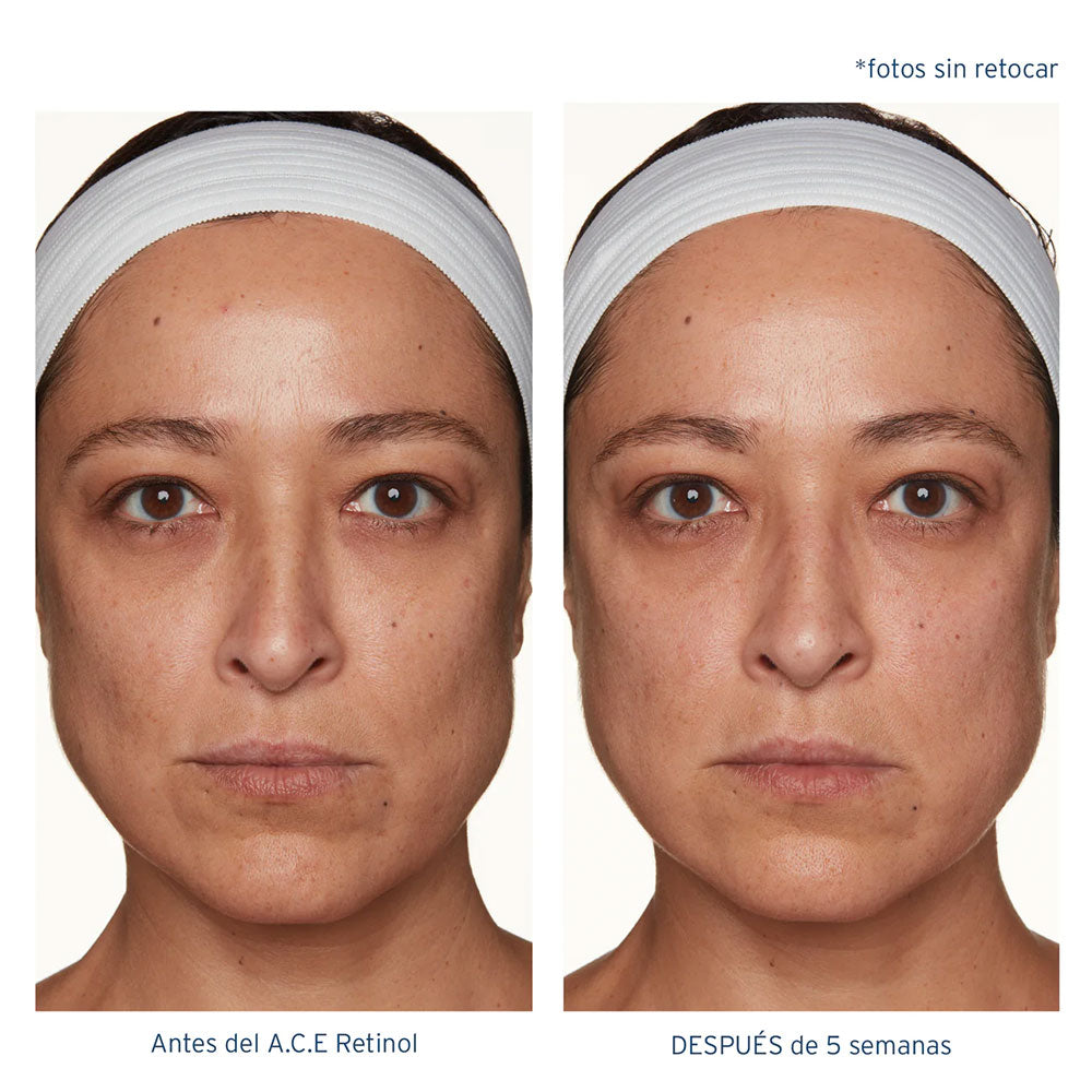 A.C.E. Aceite Regenerador Intensivo con Retinol