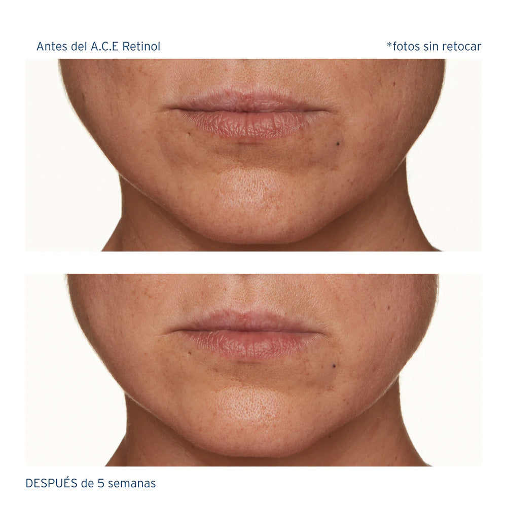 A.C.E. Aceite Regenerador Intensivo con Retinol