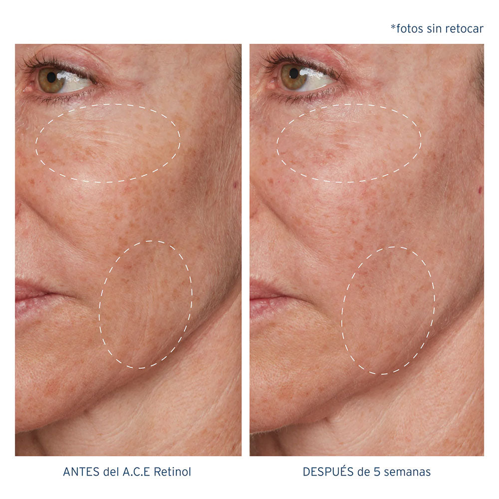 A.C.E. Aceite Regenerador Intensivo con Retinol