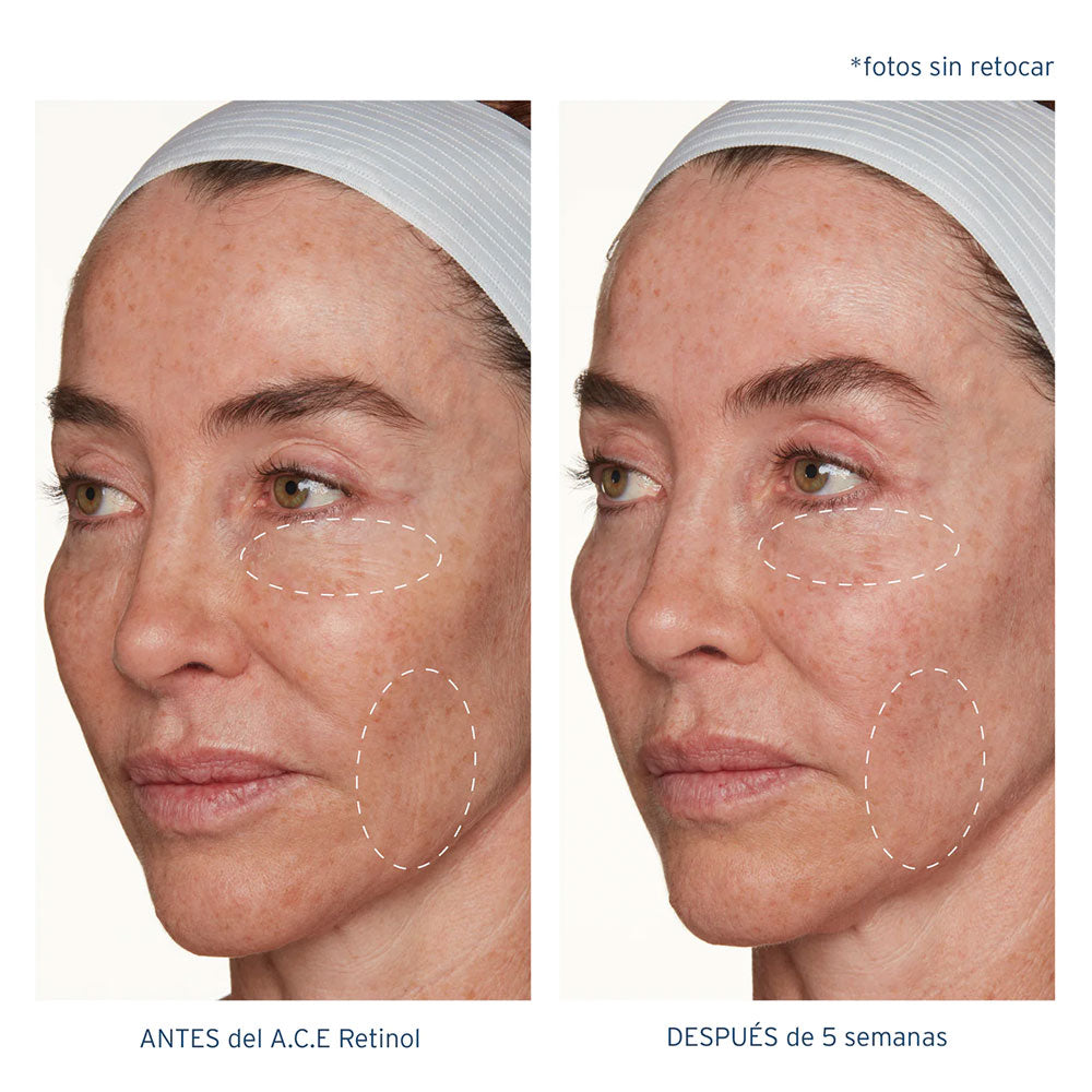 A.C.E. Aceite Regenerador Intensivo con Retinol