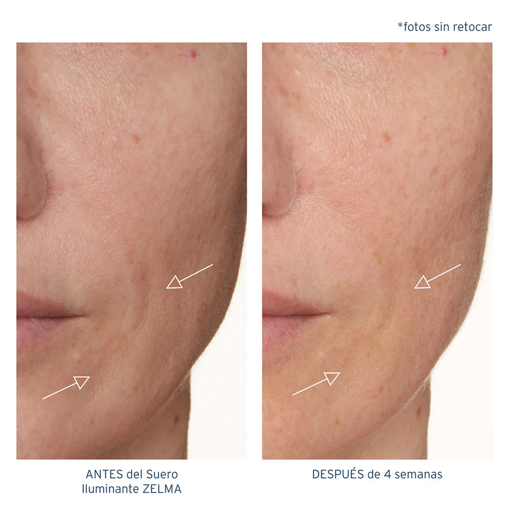 ZELMA Brightening Serum