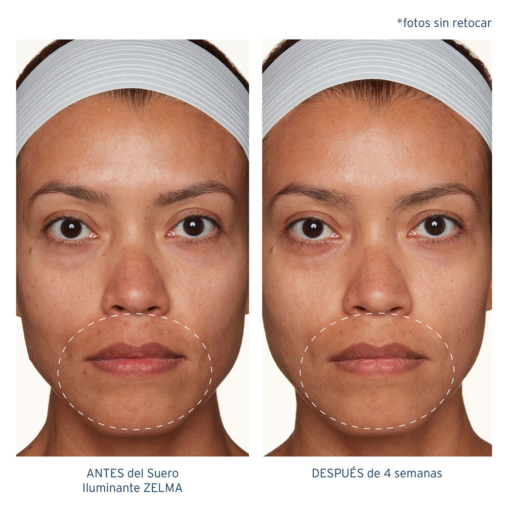 ZELMA Brightening Serum