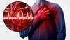 Cómo prevenir los ataques cardiacos