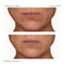 A.C.E. Retinol Intensive Rejuvenation Oil