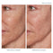 A.C.E. Retinol Intensive Rejuvenation Oil